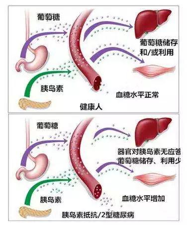 血压忽高忽低，磨损血管壁！高血压病人要格外警惕的4件事