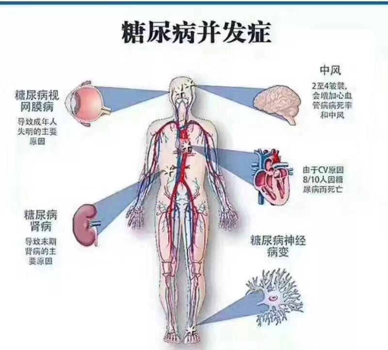 血压忽高忽低，磨损血管壁！高血压病人要格外警惕的4件事