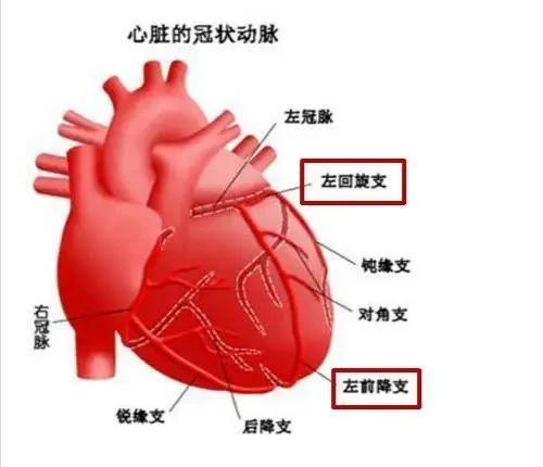 心肌桥是个什么心脏病？也可能引发心肌梗死