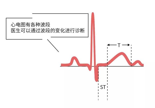 心脏不难受，为什么还要去查心电图？