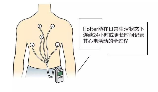 心脏不难受，为什么还要去查心电图？